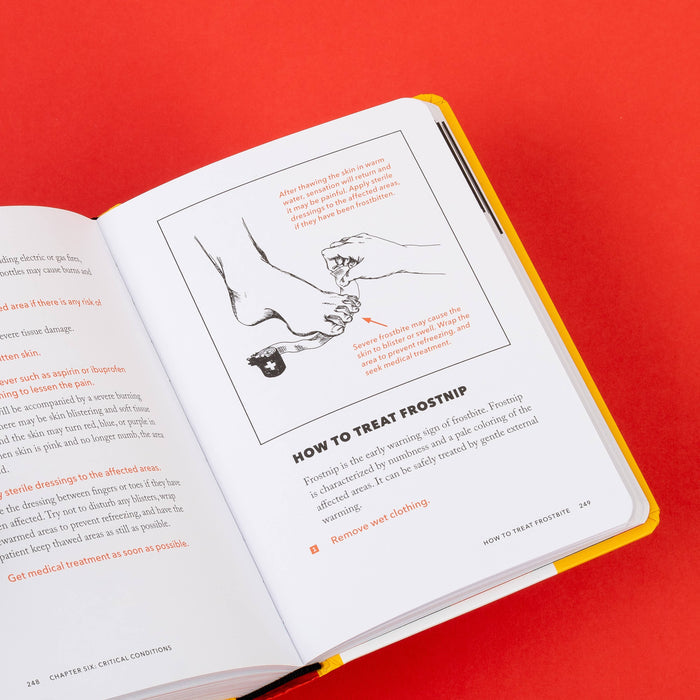 Open page from The Worst-Case Scenario Survival Handbook showing a frostbite illustration and orange treatment notes